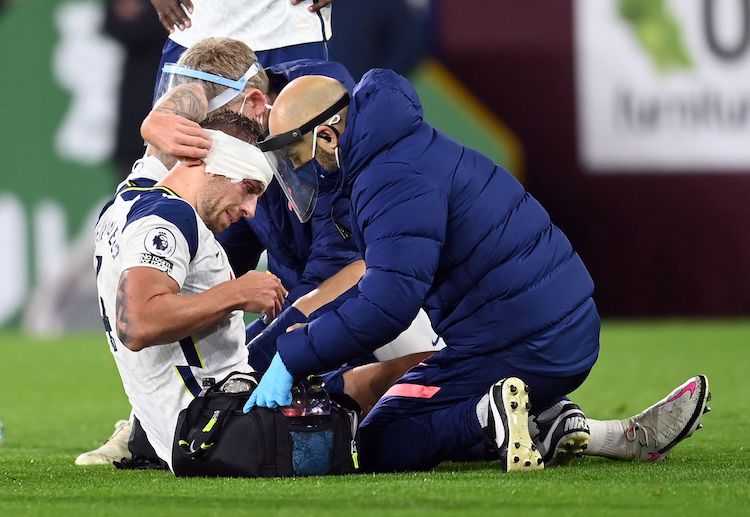 Tottenham Hotspur's Toby Alderweireld gets bloodied and bruised during a Premier League clash with Burnley